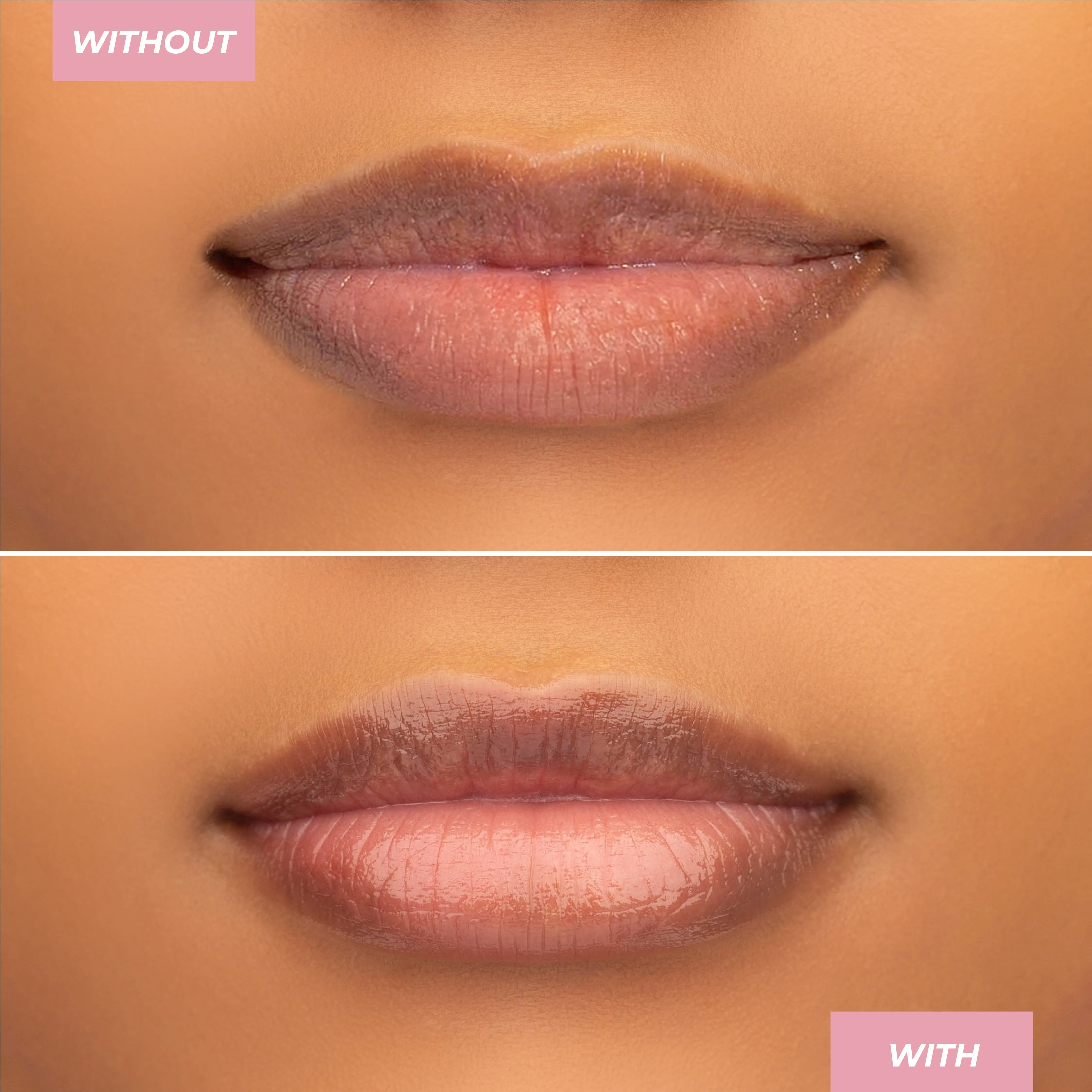 Hyaluronic Lip Balm
